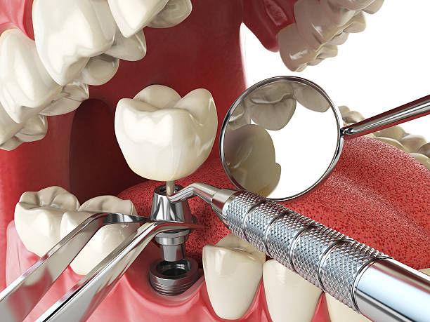 Best Emergency Dental Surgery in Valdese, NC